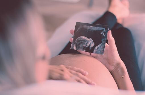 Beitragsbild Blogartikel Schwangerschaftsbeschwerden und was dagegen hilft - Frau mit Ultraschallbild ihres Babys